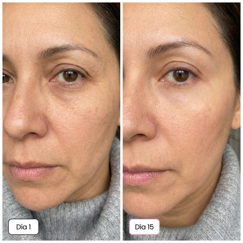 Rejuvenece y reafirma tu piel desde el día 1 | Fórmula con calcio + colágeno con complejo Rebornic