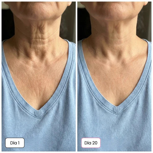 Rejuvenece y reafirma tu piel desde el día 1 | Fórmula con calcio + colágeno con complejo Rebornic
