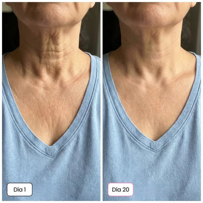 Rejuvenece y reafirma tu piel desde el día 1 | Fórmula con calcio + colágeno con complejo Rebornic