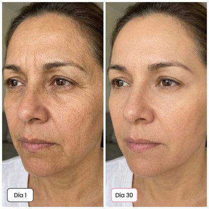 Rejuvenece y reafirma tu piel desde el día 1 | Fórmula con calcio + colágeno con complejo Rebornic