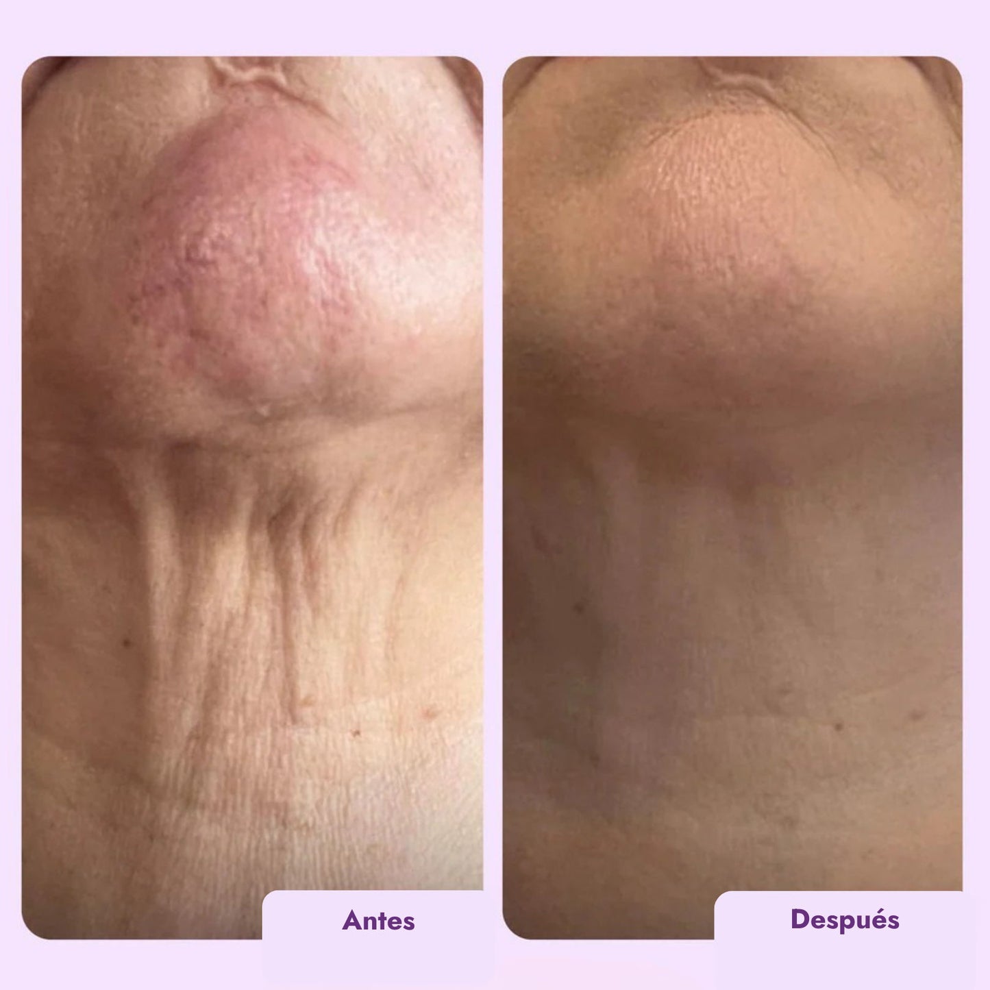 Crema Reafirmante Intensiva para Cuello y Escote