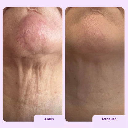 Crema Reafirmante Intensiva para Cuello y Escote