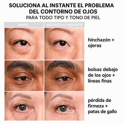 InstantLift+ Elimina bolsas y ojeras al instante | Fórmula fácil de usar